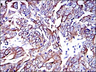 Immunohistochemistry-Paraffin: Cytokeratin 19 Antibody (4E8) - BSA Free [NBP2-22116]