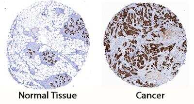 Immunohistochemistry: Cytokeratin 19 Antibody (963410) [MAB35062]
