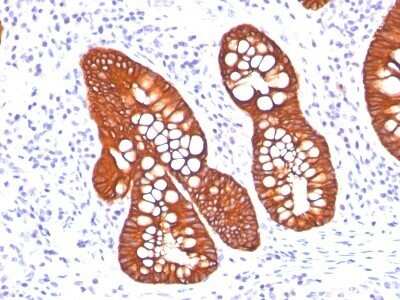Immunohistochemistry-Paraffin: Cytokeratin 19 Antibody (A53-B/A2.26 + BA17) - IHC-Prediluted [NBP2-44825]