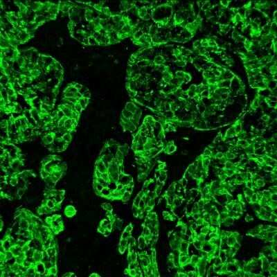 Immunohistochemistry: Cytokeratin 19 Antibody (A53-B/A2.26 + BA17) [NBP2-34272]