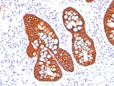 Immunohistochemistry-Paraffin: Cytokeratin 19 Antibody (A53-B/A2.26 + BA17) [NBP2-34272]