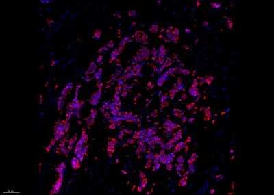 Immunohistochemistry-Frozen: Cytokeratin 19 Antibody (A53-B/A2.26) - Azide and BSA Free [NBP2-33134]
