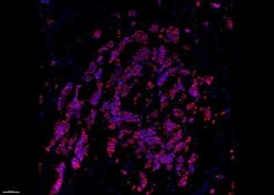 Immunohistochemistry-Frozen: Cytokeratin 19 Antibody (A53-B/A2.26) [NBP2-15186]