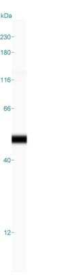Simple Western: Cytokeratin 19 Antibody (A53-B/A2.26) [NBP2-15186]