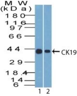 Western Blot: Cytokeratin 19 Antibody (A53-B/A2.26) [NBP2-15186]