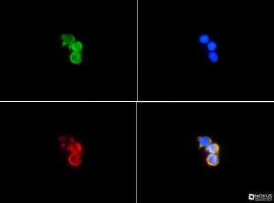 Immunocytochemistry/ Immunofluorescence: Cytokeratin 19 Antibody - BSA Free [NB100-687]