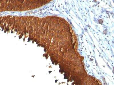 Immunohistochemistry-Paraffin: Cytokeratin 19 Antibody (KRT19/799 + KRT19/800) - Azide and BSA Free [NBP2-47948]