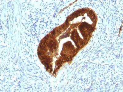 Immunohistochemistry-Paraffin: Cytokeratin 19 Antibody (KRT19/799 + KRT19/800) - Azide and BSA Free [NBP2-47948]