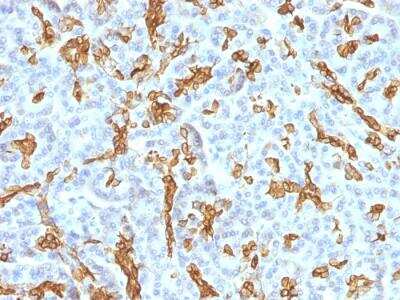 Immunohistochemistry-Paraffin: Cytokeratin 19 Antibody (KRT19/799 + KRT19/800) - Azide and BSA Free [NBP2-47948]