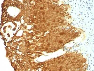 Immunohistochemistry-Paraffin: Cytokeratin 19 Antibody (KRT19/799 + KRT19/800) - IHC-Prediluted [NBP2-48101]