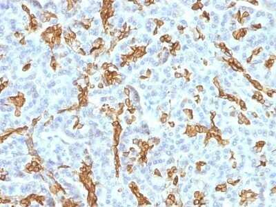 Immunohistochemistry-Paraffin: Cytokeratin 19 Antibody (KRT19/799 + KRT19/800) - IHC-Prediluted [NBP2-48101]