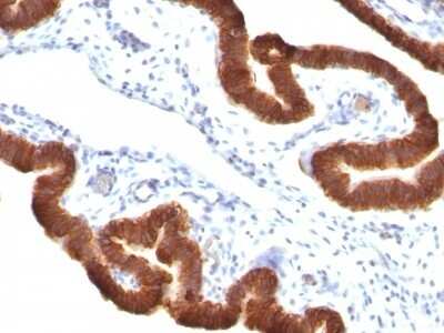 Immunohistochemistry-Paraffin: Cytokeratin 19 Antibody (KRT19/799 + KRT19/800) [NBP2-44829]
