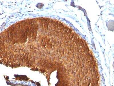 Immunohistochemistry-Paraffin: Cytokeratin 19 Antibody (KRT19/799) - Azide and BSA Free [NBP2-47945]