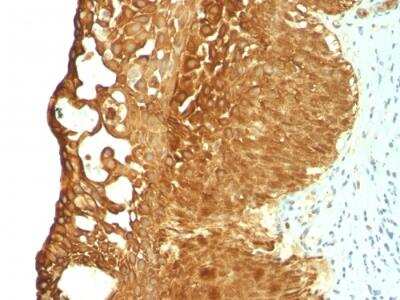 Immunohistochemistry-Paraffin: Cytokeratin 19 Antibody (KRT19/799) - Azide and BSA Free [NBP2-47945]