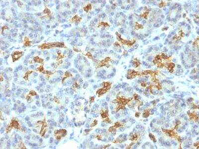 Immunohistochemistry-Paraffin: Cytokeratin 19 Antibody (KRT19/799) - Azide and BSA Free [NBP2-47945]