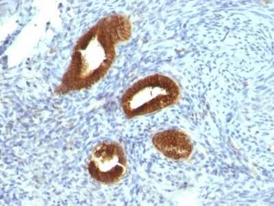 Immunohistochemistry-Paraffin: Cytokeratin 19 Antibody (KRT19/799) [NBP2-44826]