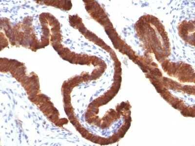Immunohistochemistry-Paraffin: Cytokeratin 19 Antibody (KRT19/799) [NBP2-44826]