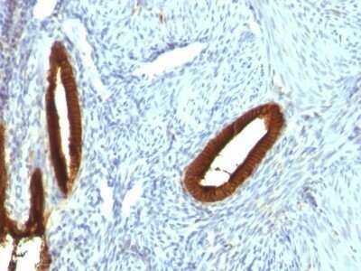 Immunohistochemistry-Paraffin: Cytokeratin 19 Antibody (KRT19/800) - Azide and BSA Free [NBP2-47946]