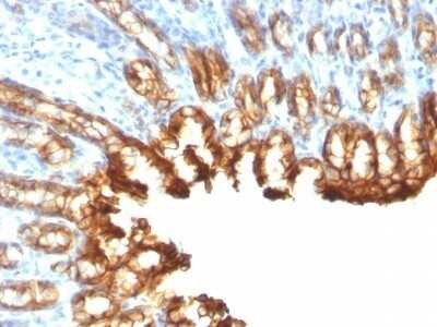 Immunohistochemistry-Paraffin: Cytokeratin 19 Antibody (KRT19/800) - Azide and BSA Free [NBP2-47946]