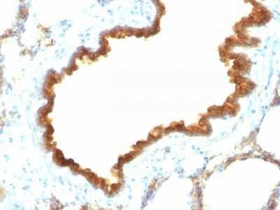 Immunohistochemistry-Paraffin: Cytokeratin 19 Antibody (KRT19/800) - Azide and BSA Free [NBP2-47946]