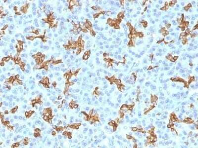 Immunohistochemistry-Paraffin: Cytokeratin 19 Antibody (KRT19/800) - IHC-Prediluted [NBP2-48095]