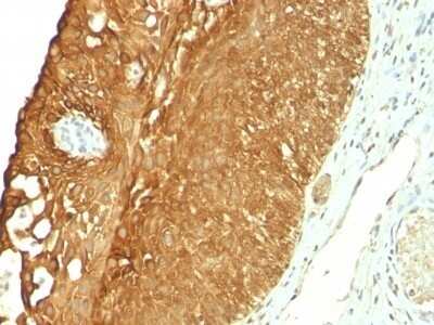 Immunohistochemistry-Paraffin: Cytokeratin 19 Antibody (KRT19/800) - IHC-Prediluted [NBP2-48095]