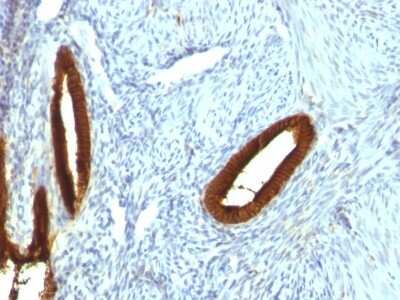 Immunohistochemistry-Paraffin: Cytokeratin 19 Antibody (KRT19/800) [NBP2-44827]