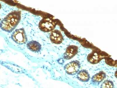 Immunohistochemistry-Paraffin: Cytokeratin 19 Antibody (KRT19/800) [NBP2-44827]