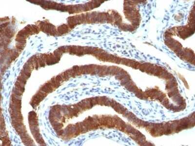 Immunohistochemistry-Paraffin: Cytokeratin 19 Antibody (Ks19.1) - IHC-Prediluted [NBP2-48096]