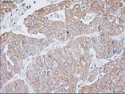 Immunohistochemistry: Cytokeratin 19 Antibody (OTI3F8) - Azide and BSA Free [NBP2-71092]