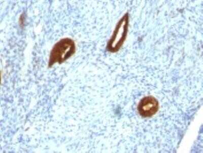 Immunohistochemistry-Paraffin: Cytokeratin 19 Antibody (SPM266) - Azide and BSA Free [NBP2-34405]