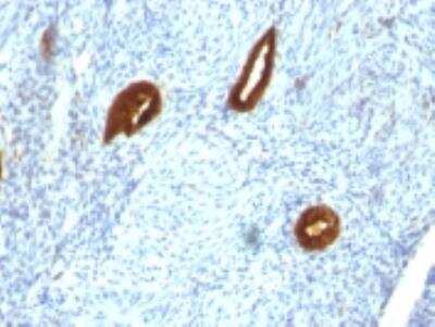 Immunohistochemistry-Paraffin: Cytokeratin 19 Antibody (SPM266) [NBP2-34357]