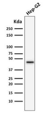 Western Blot: Cytokeratin 19 Antibody (SPM266) [NBP2-34357]