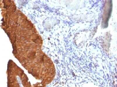 Immunohistochemistry-Paraffin: Cytokeratin 19 Antibody (SPM561) - Azide and BSA Free [NBP2-34426]