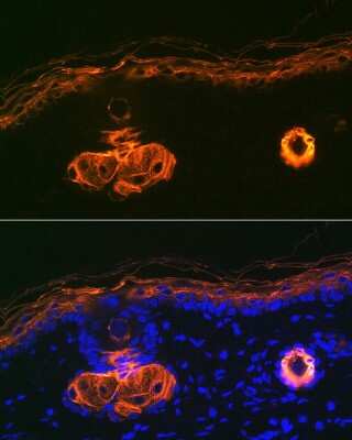 Immunohistochemistry: Cytokeratin 2 Antibody (9T3Q2) [NBP3-16139]