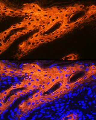 Immunohistochemistry: Cytokeratin 2 Antibody (9T3Q2) [NBP3-16139]