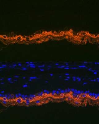 Immunohistochemistry: Cytokeratin 2 Antibody (9T3Q2) [NBP3-16139]