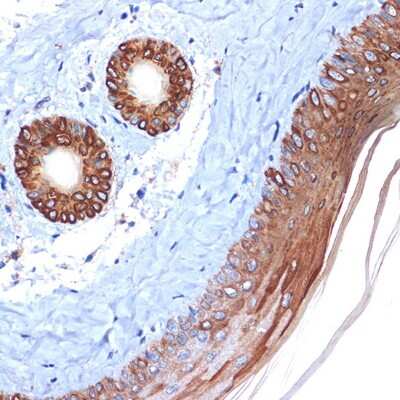 Immunohistochemistry-Paraffin: Cytokeratin 2 Antibody (9T3Q2) [NBP3-16139]