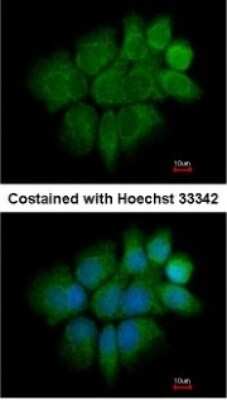 Immunocytochemistry/ Immunofluorescence: Cytokeratin 2 Antibody [NBP1-31423]