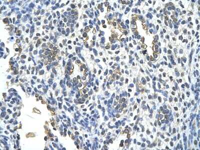 Immunohistochemistry: Cytokeratin 2 Antibody [NBP1-55126]
