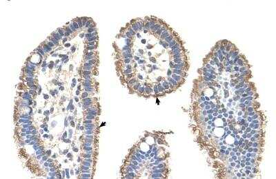 Immunohistochemistry-Paraffin: Cytokeratin 2 Antibody [NBP1-55126]