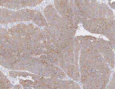 Immunohistochemistry-Paraffin: Cytokeratin 2 Antibody [NBP3-12790]