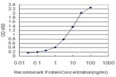 ELISA: Cytokeratin 20 Antibody (2G3-1C8) [H00054474-M01]
