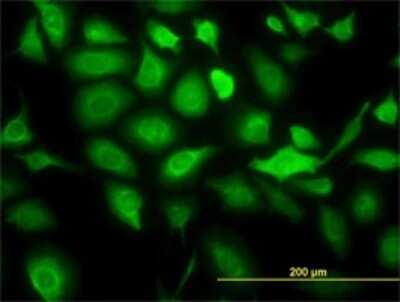 Immunocytochemistry/ Immunofluorescence: Cytokeratin 20 Antibody (2G3-1C8) [H00054474-M01]