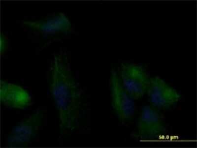 Immunocytochemistry/ Immunofluorescence: Cytokeratin 20 Antibody (2G3-1C8) [H00054474-M01]