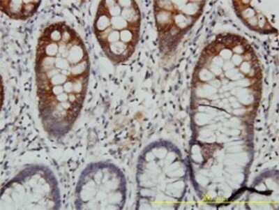 Immunohistochemistry-Paraffin: Cytokeratin 20 Antibody (2G3-1C8) [H00054474-M01]