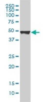 Western Blot: Cytokeratin 20 Antibody (2G3-1C8) [H00054474-M01]