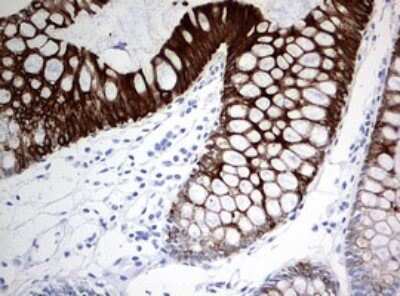 Immunohistochemistry: Cytokeratin 20 Antibody (OTI3G1) [NBP2-45556]