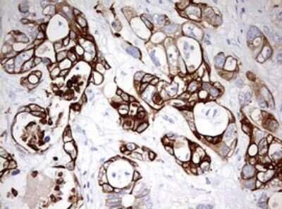 Immunohistochemistry: Cytokeratin 20 Antibody (OTI3G1) [NBP2-45556]