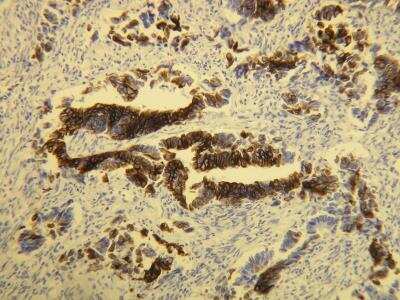 Immunohistochemistry-Paraffin: Cytokeratin 20 Antibody (E19-I) [NBP2-21840]